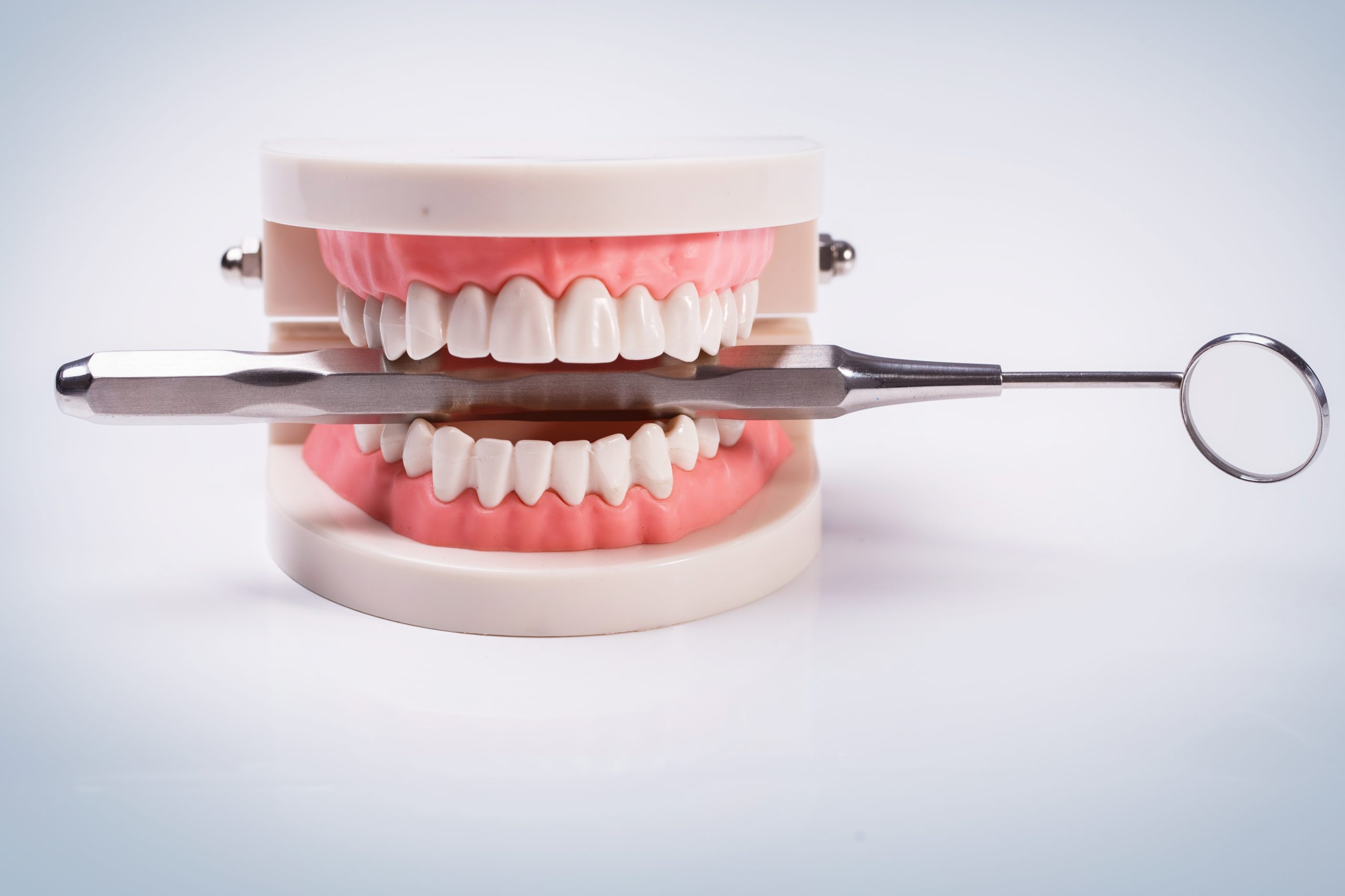 Dentier ou implant – Lequel choisir ?